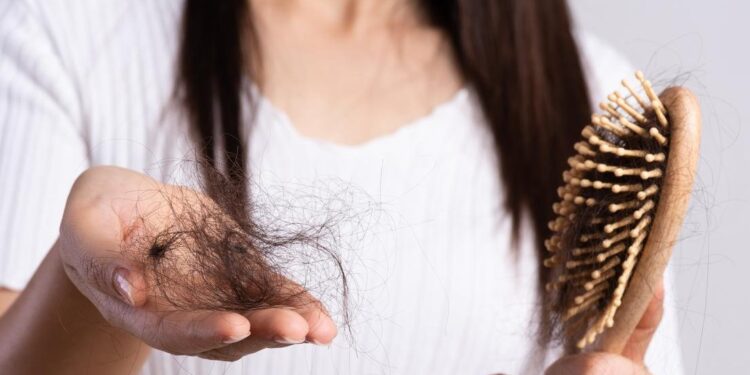 لو مش فاضية تهتمي بشعرك.. اعرفي أفضل 7 زيوت لحمايته من التساقط