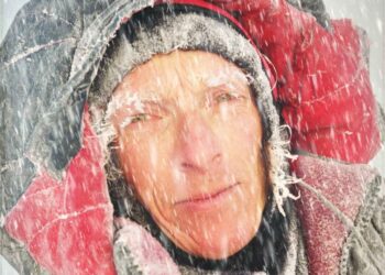 علماء يبتكرون كريم جديد مضاد للتجمد يمنع إصابات الجلد