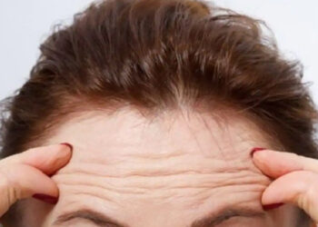 4 طرق فعالة لمنع الخطوط الدقيقة على الجبين والتخلص منها
