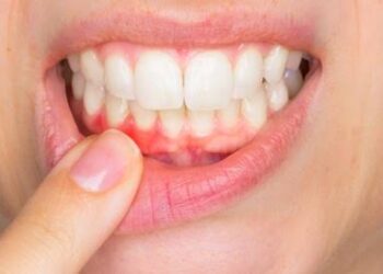 كيف تحمي نفسك من خطر الإصابة بأمراض اللثة؟