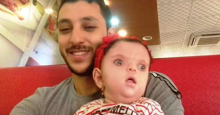 رزان بدأت مشوارها بعد 20 يوم ولادة.. عملية كل 3 شهور ولسه بطلة ومكملة