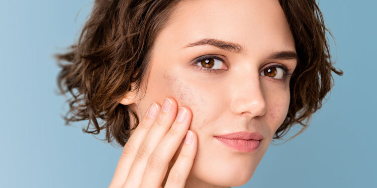 البشرة الحساسة.. 5 علامات تدل على أن لديكِ هذا النوع