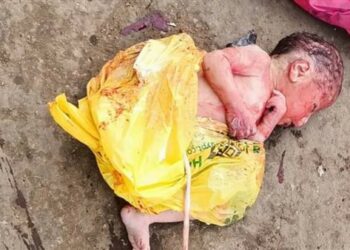 التحقيق مع فتاة ألقت طفلها من الطابق السادس فور ولادته بالطالبية