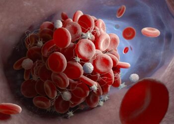 العلماء يحددون “الأجسام المضادة” المرتبطة بتجلط الدم الشديد الناتج عن فيروس كورونا