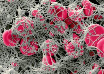 جلطات دموية لدى مرضى كورونا تحفزها أجسام مضادة “مارقة”