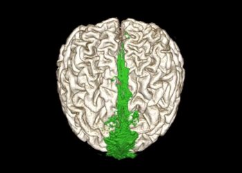 تقنية جديدة توفر الوقت لأوعية التخلص من النفايات في الدماغ البشري