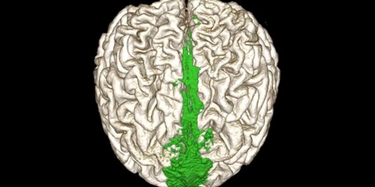 تقنية جديدة توفر الوقت لأوعية التخلص من النفايات في الدماغ البشري