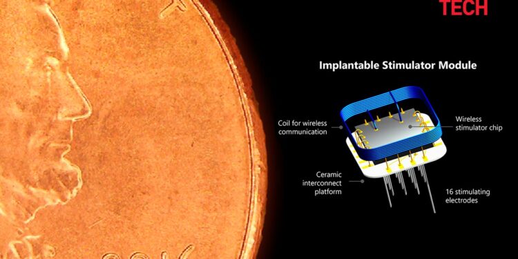 أول عملية زرع ناجحة لزراعة الدماغ ذات الرؤية الاصطناعية الثورية