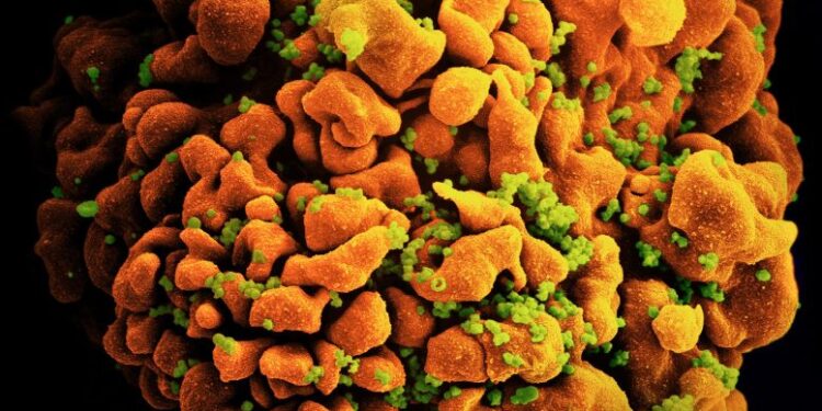 اكتشاف متغير جديد مدمّر لفيروس نقص المناعة البشرية في هولندا