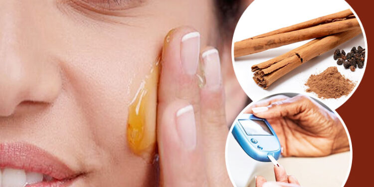 7 فوائد مذهلة القرفة على الصحة والبشرة.. تعرف عليهم