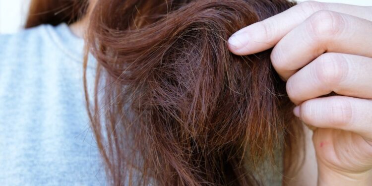 منع تساقط الشعر.. إليكِ ما يقوله الخبراء