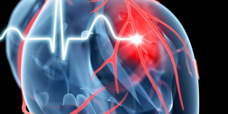 دراسة جديدة تحدد الجينات المسببة أمراض القلب التاجية و النوبات القلبية