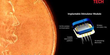 أول عملية زرع ناجحة لزراعة الدماغ ذات الرؤية الاصطناعية الثورية