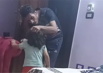 الأمن يفحص فيديو الاعتداء على طفل وإشعال النار في شعره وجسده