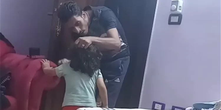 الأمن يفحص فيديو الاعتداء على طفل وإشعال النار في شعره وجسده